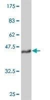 Anti-TEK Antibody