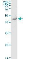 Anti-TEKT2 Antibody