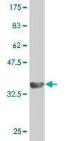 Anti-TEKT2 Antibody