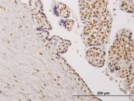 Anti-TESK2 Antibody