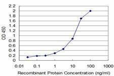 Anti-TESK2 Antibody