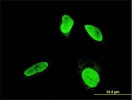 Anti-TESK2 Antibody
