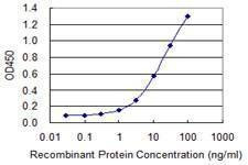 Anti-TFDP1 Antibody