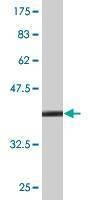 Anti-TFF2 Antibody