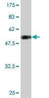 Anti-TGIF2 Antibody