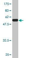 Anti-TGIF2 Antibody