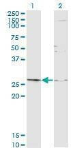 Anti-TGIF2 Antibody