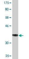 Anti-THOC3 Antibody