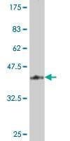 Anti-TIE1 Antibody