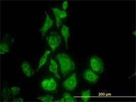 Anti-TIMP2 Antibody
