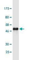 Anti-TIMP2 Antibody