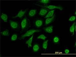 Anti-TIMP2 Antibody
