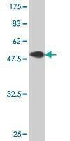 Anti-TK1 Antibody