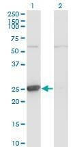 Anti-TK1 Antibody