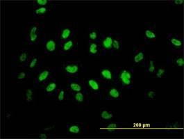 Anti-TLK2 Antibody