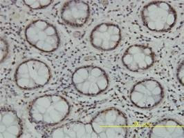 Anti-TLK2 Antibody