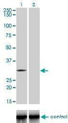 Anti-TLX3 Antibody