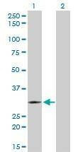 Anti-TLX3 Antibody