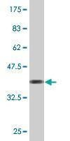 Anti-TMEFF2 Antibody