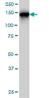 Anti-TMEM1 Antibody