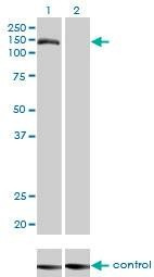 Anti-TMEM1 Antibody