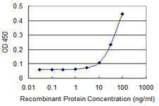 Anti-TMPRSS5 Antibody
