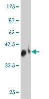 Anti-TNFRSF19L Antibody