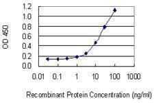 Anti-TNR Antibody