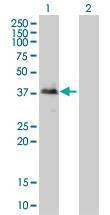 Anti-TOB2 Antibody