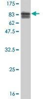Anti-TOE1 Antibody