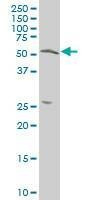 Anti-TOM1 Antibody