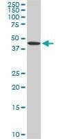 Anti-ADPGK Antibody