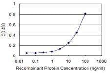 Anti-ADPGK Antibody