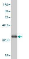 Anti-ADPGK Antibody
