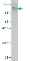 Anti-TOP3B Antibody