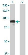 Anti-TOP3B Antibody