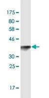 Anti-TOPORS Antibody
