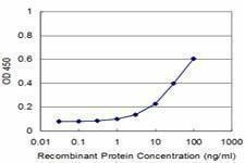 Anti-TOPORS Antibody