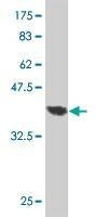 Anti-TRADD Antibody