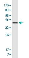 Anti-TRAK1 Antibody