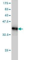 Anti-TRIB3 Antibody
