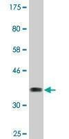 Anti-TRIM16 Antibody