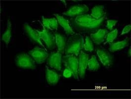 Anti-TRIM25 Antibody