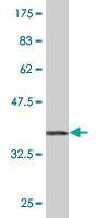 Anti-TRIM25 Antibody