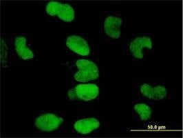 Anti-TRIM28 Antibody