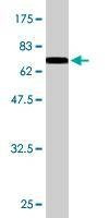 Anti-ADRM1 Antibody