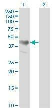 Anti-ADRM1 Antibody