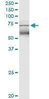 Anti-TRIM47 Antibody