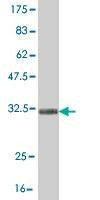 Anti-TRIM49 Antibody