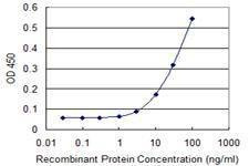Anti-TSC2 Antibody